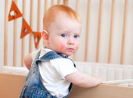 photo of a redhead little boy with red cheeks