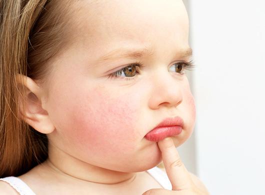 photo of little girl with reed cheeks pouting